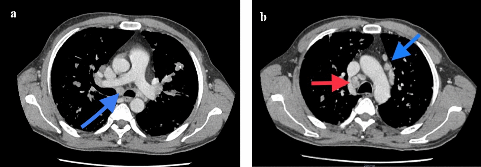 Fig. 1