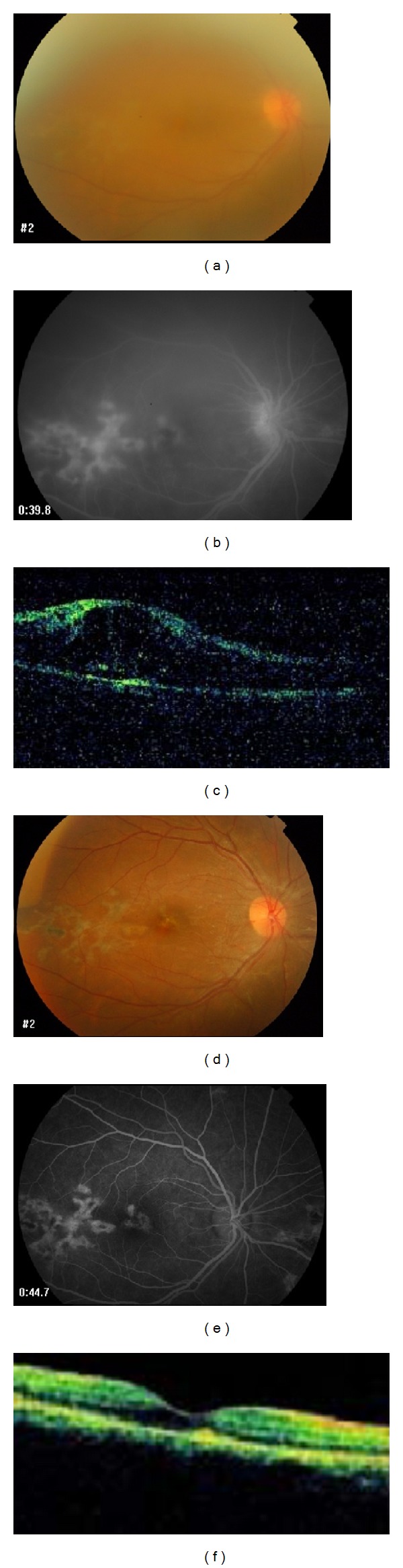 Figure 2