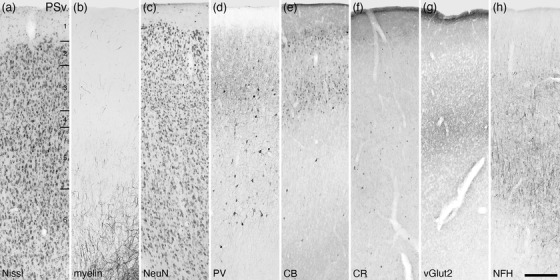 FIGURE 30