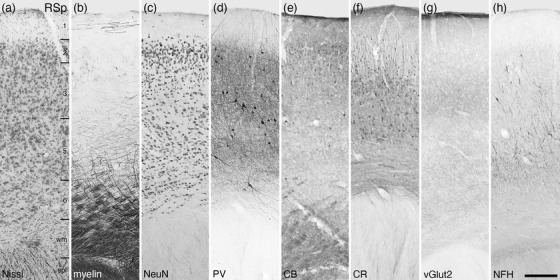 FIGURE 28