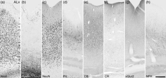 FIGURE 23