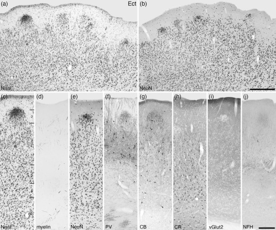 FIGURE 25