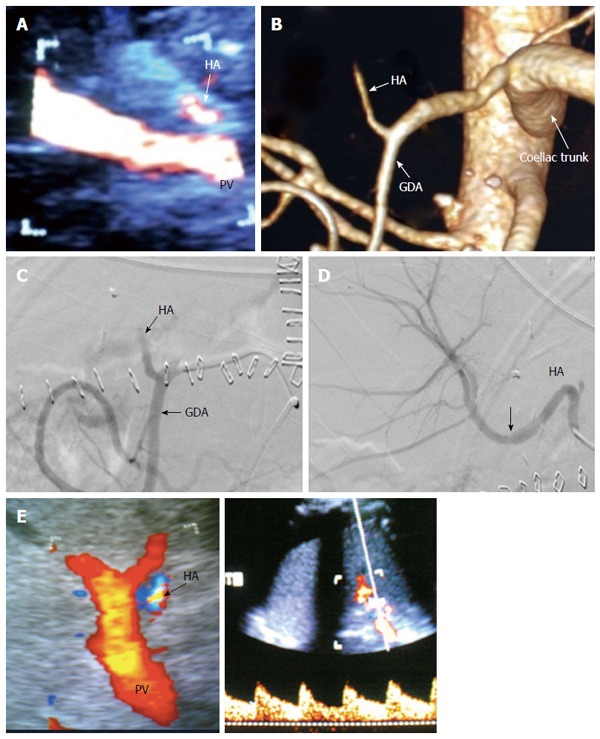 Figure 31