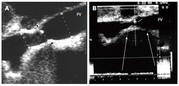 Figure 20