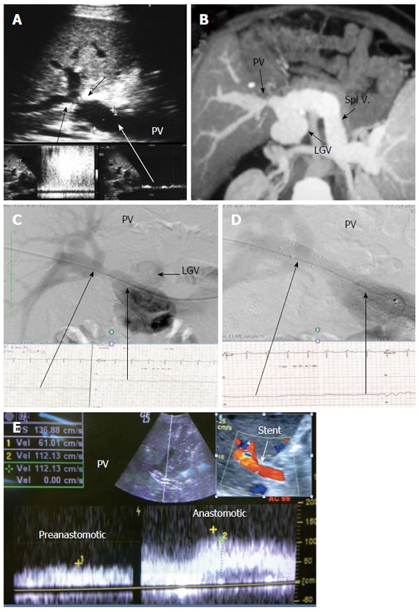 Figure 21