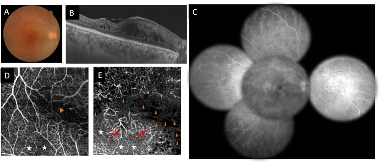 Fig. 12