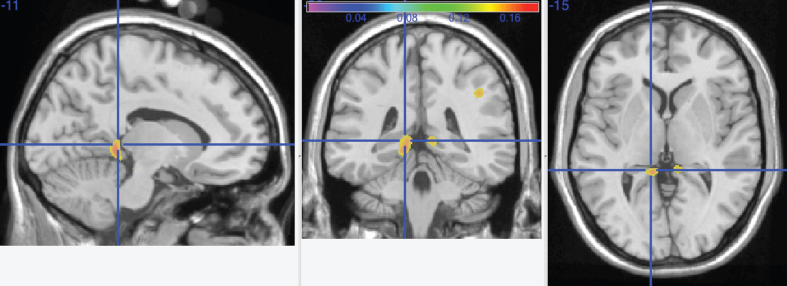 Fig.2