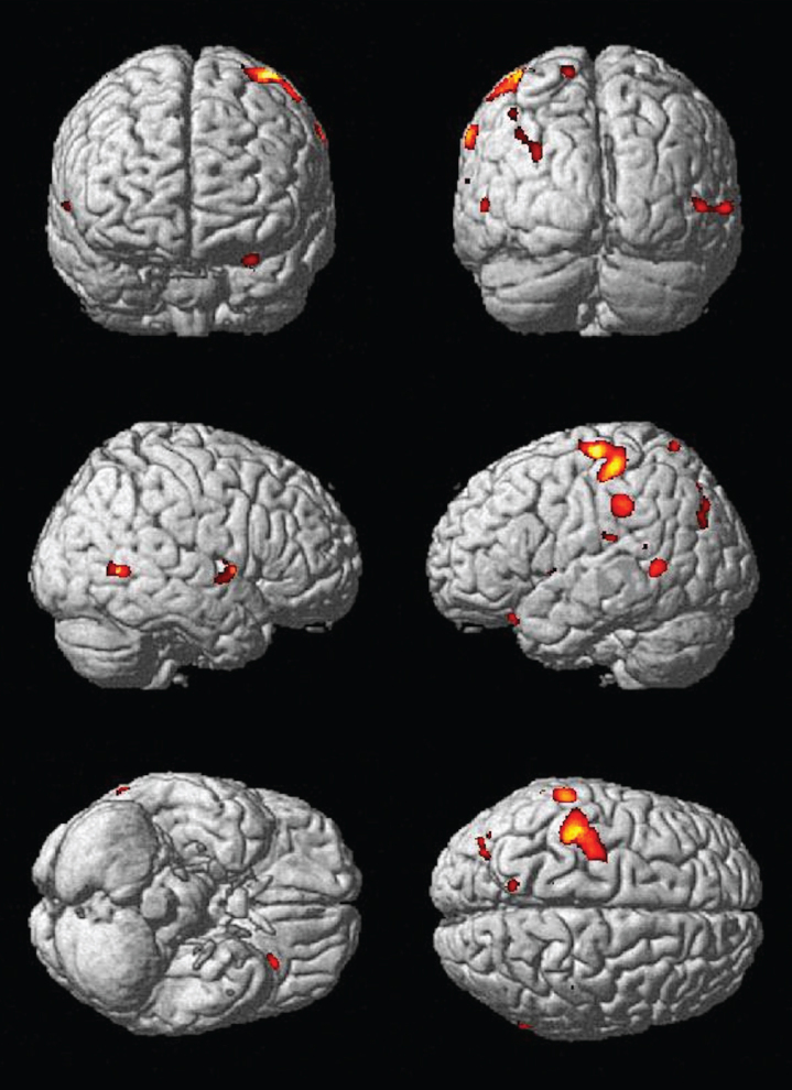 Fig.3