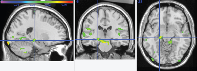 Fig.4