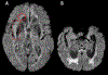Fig. 1: