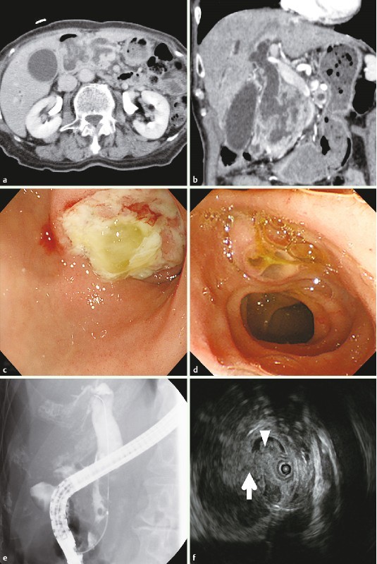 Fig. 3 a, b