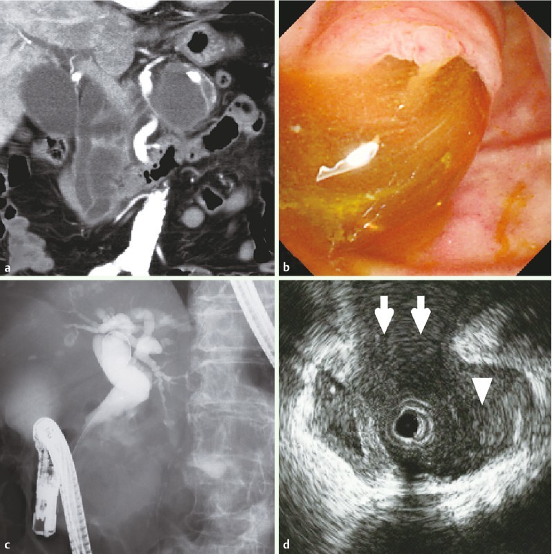 Fig. 1 a