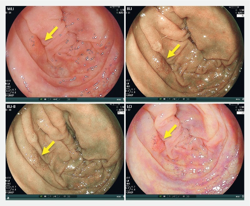 Supplementary Fig. 2