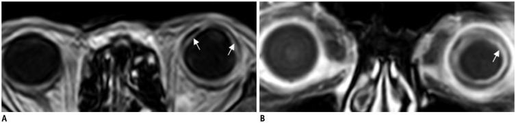 Fig. 12