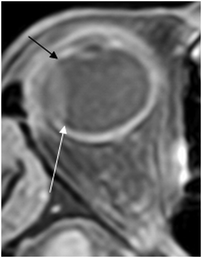 Fig. 13