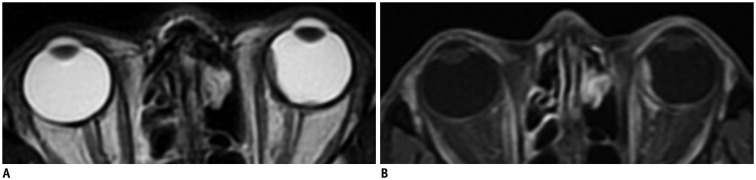 Fig. 17