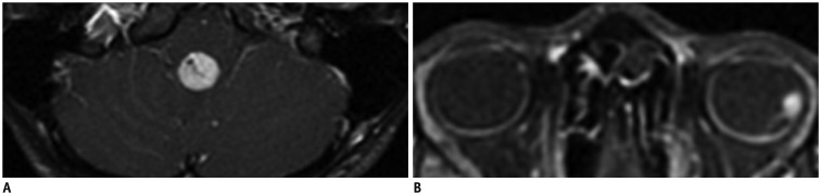 Fig. 18