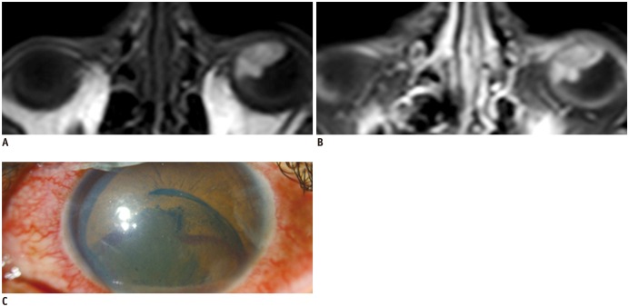 Fig. 16