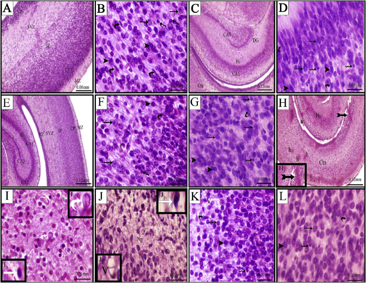 Fig. 2