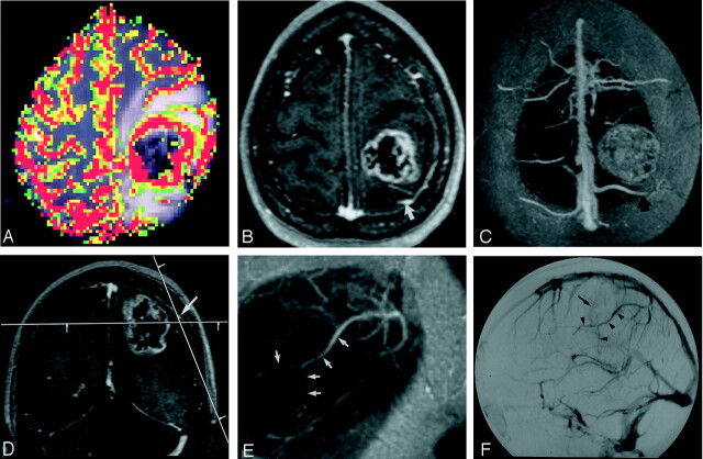 Fig 2.