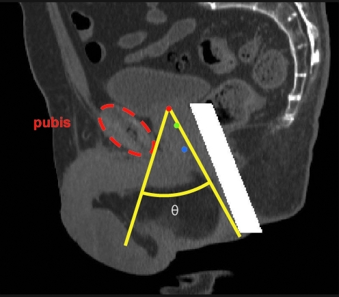 FIG. 1.