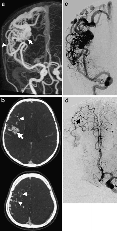 Fig. 5