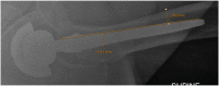Appendix Figure 1