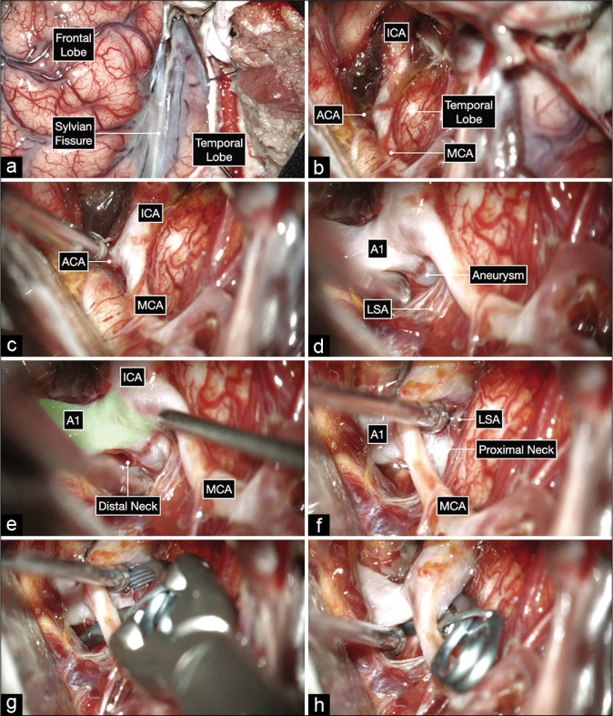 Figure 4: