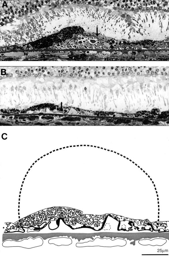 Figure 12  