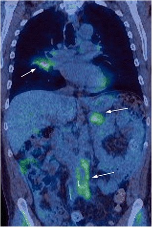 Fig. 5