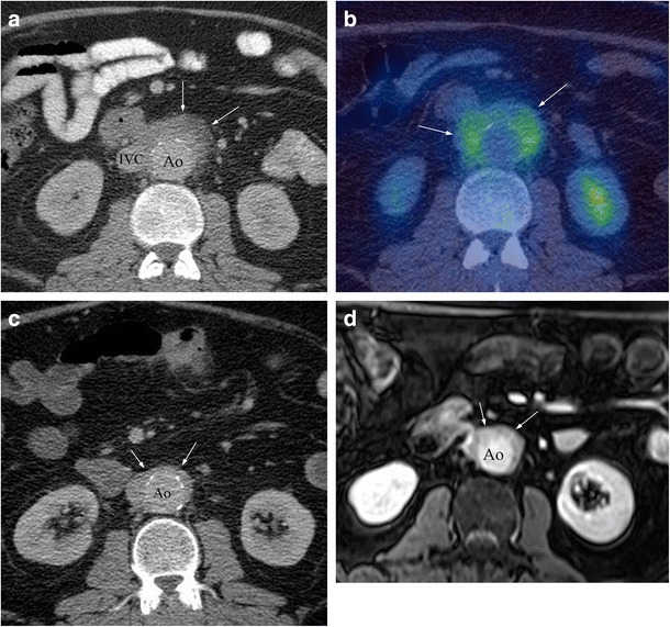 Fig. 11
