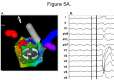 Figure 5A.