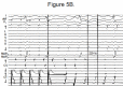 Figure 5B.