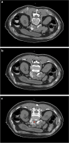 Fig. 3