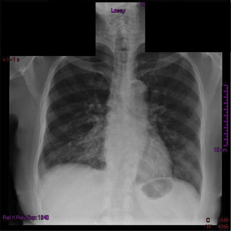 Fig. 1