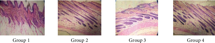 Figure 23