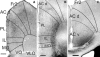 Fig. 14