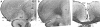 Fig. 11