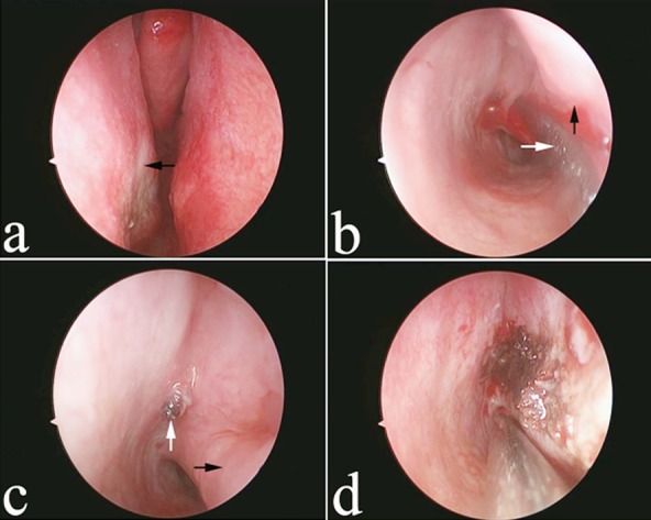 Fig.1