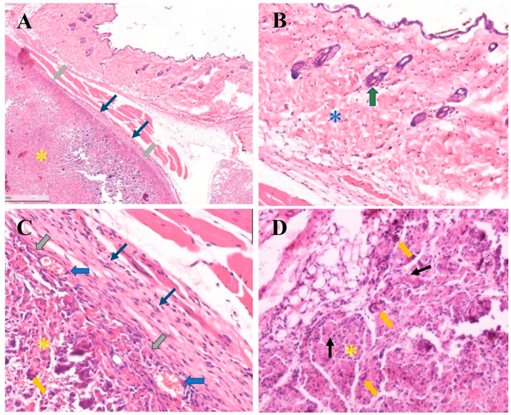 Figure 11