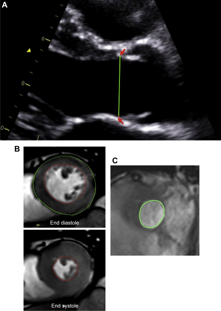 Figure 1