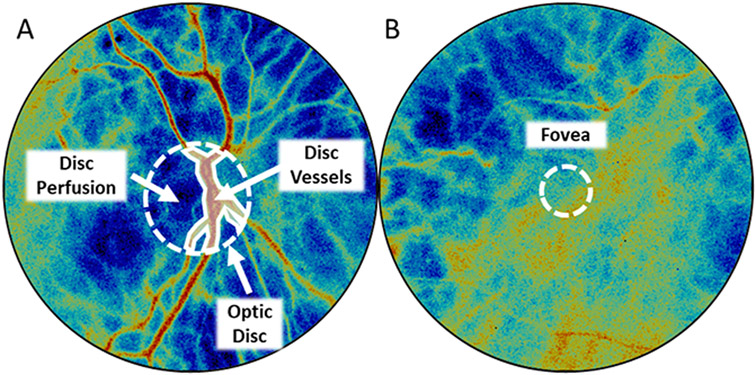 Figure 2: