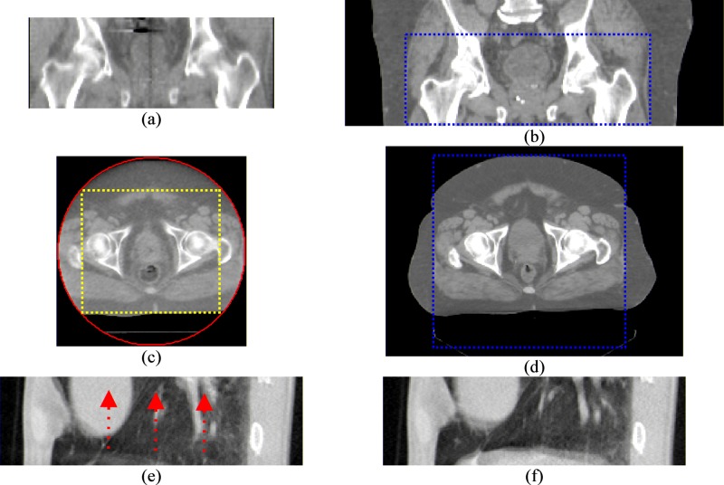 FIG. 1.