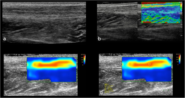 Fig. 6