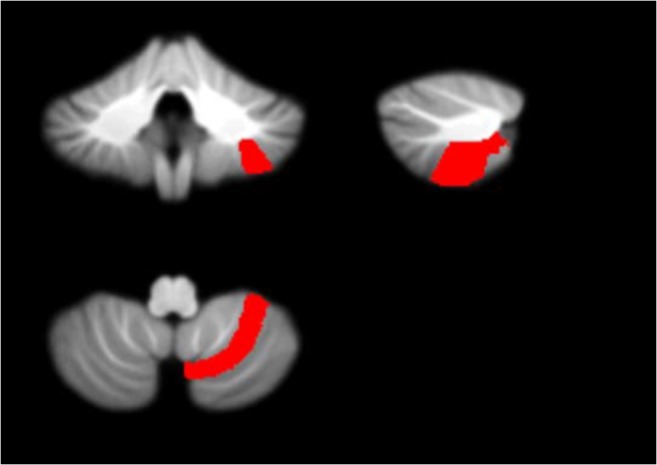 Fig. 10