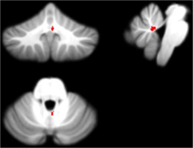 Fig. 11