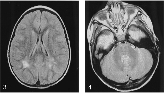 Fig 3.