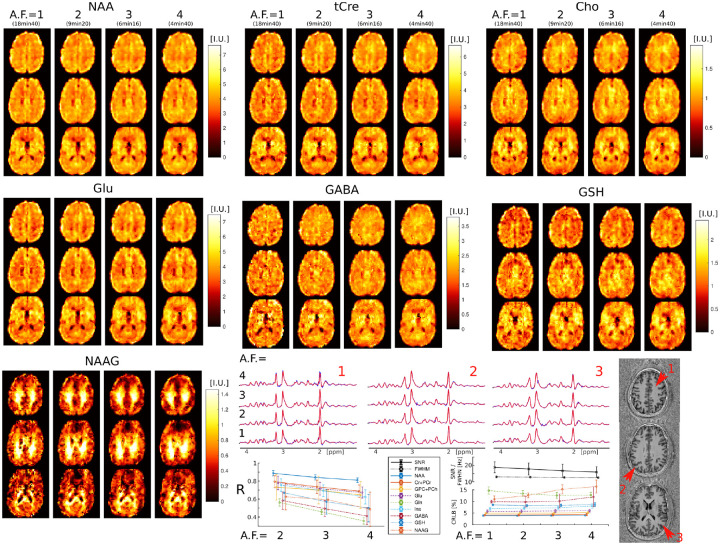 FIG. 4: