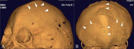 Figure 9(A, B)