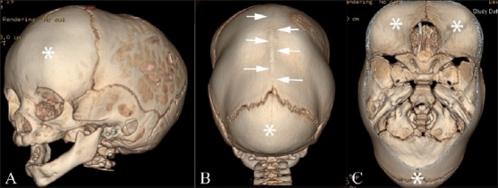 Figure 2(A-C)